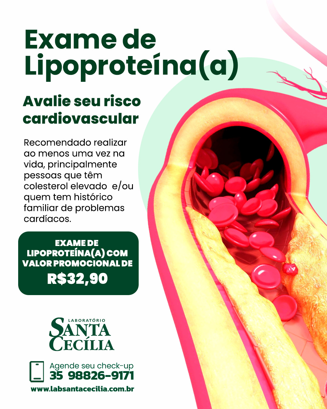 exame de lipoproteína (a)