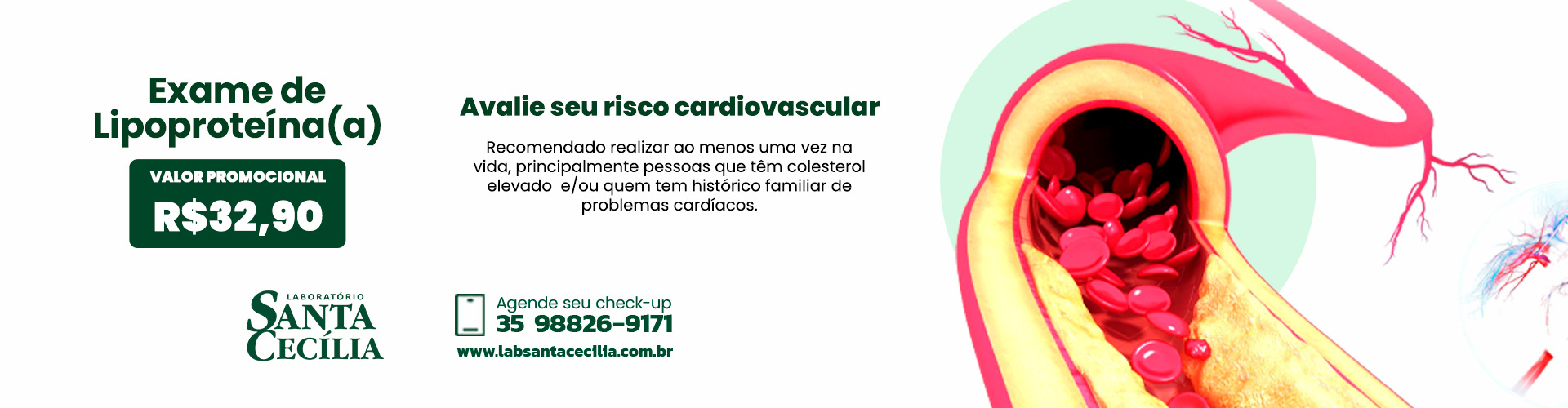 exame de lipoproteína (a)