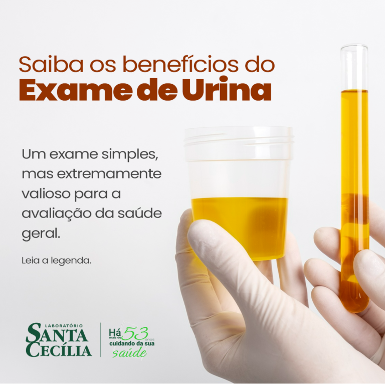 Exame de urina