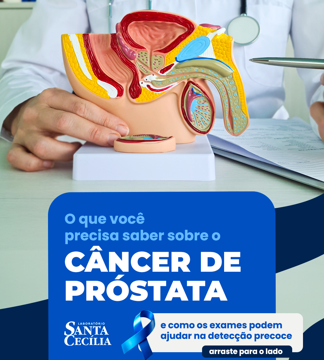 2 - FEEDCâncer de próstata: o que você precisa saber e como os exames ajudam na detecção precoce - exame de psa - laboratório santa cecília lavras