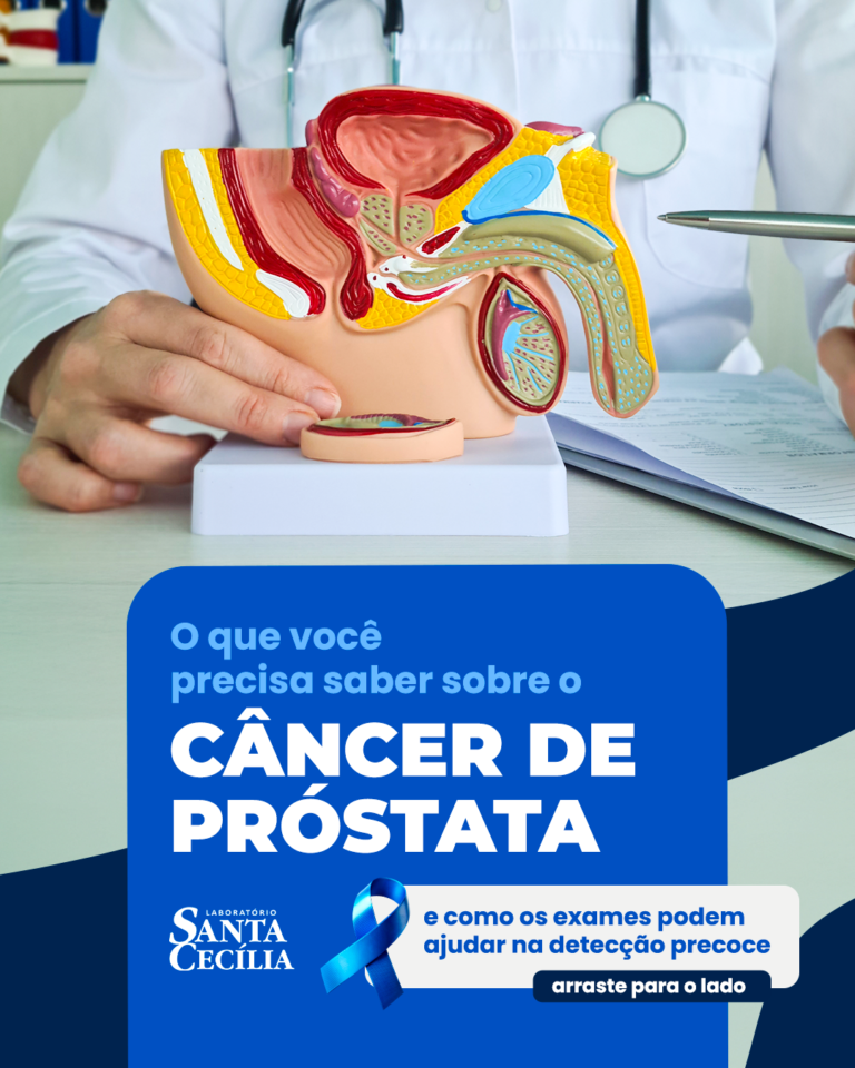 2 - FEEDCâncer de próstata: o que você precisa saber e como os exames ajudam na detecção precoce - exame de psa - laboratório santa cecília lavras