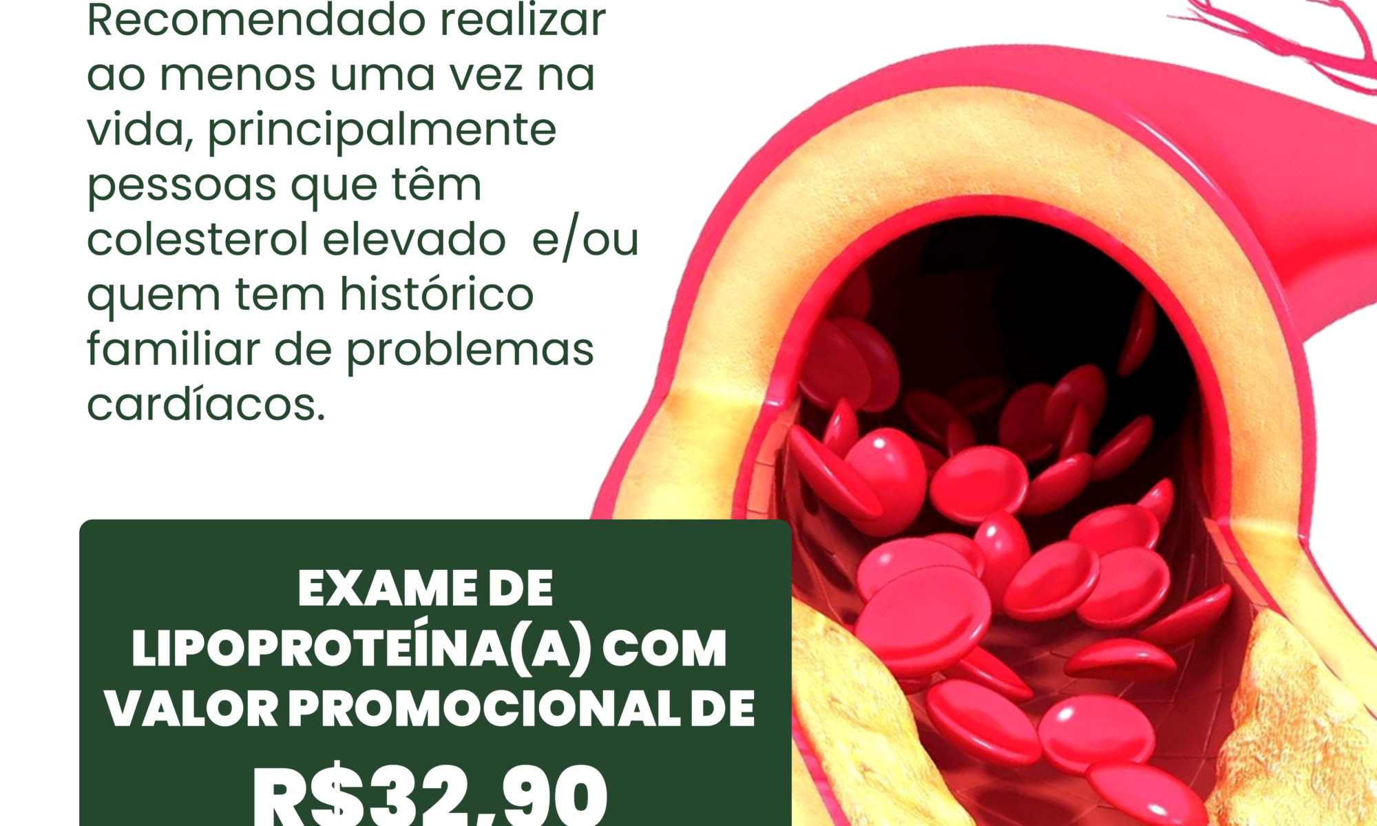 exame de lipoproteína (a)